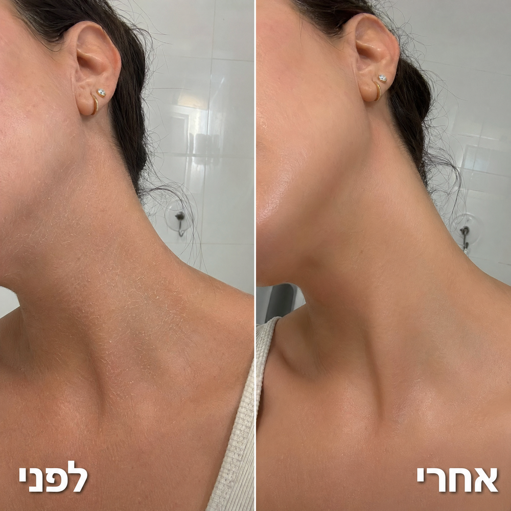 תוצאה אמיתית