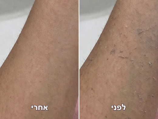 זרוע לפני ואחרי שימוש אחד בכפפה
